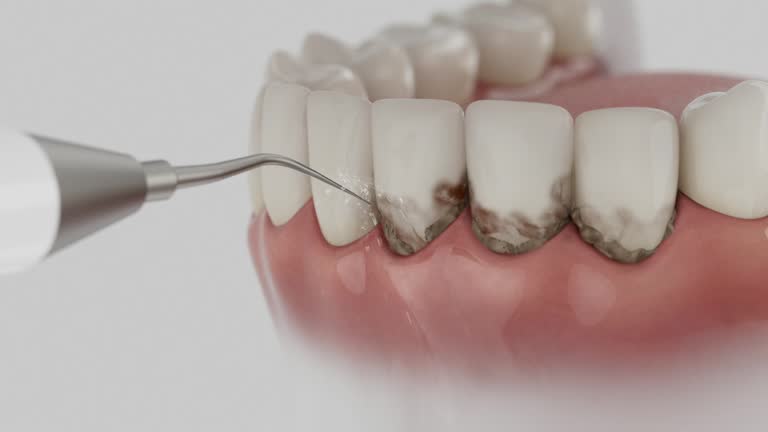 Trusted Tooth Extraction service in Wartburg, TN - Dentist Open Now